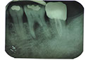 %_tempFileNameImplant%20104a1%