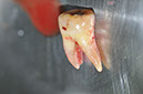 %_tempFileNameImplant%20104a2%