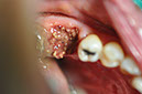 %_tempFileNameImplant%20104a4%