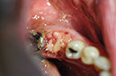%_tempFileNameImplant%20104a5%
