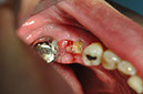 %_tempFileNameImplant%20104a6%