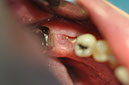 %_tempFileNameImplant%20104a7%
