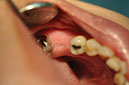%_tempFileNameImplant%20104a8%