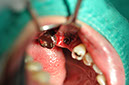 %_tempFileNameImplant%20104b1%
