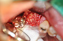 %_tempFileNameImplant%20104b4%