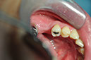 %_tempFileNameImplant%20104b5%