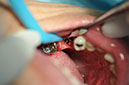 %_tempFileNameImplant%20104b6%