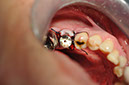 %_tempFileNameImplant%20104b7%