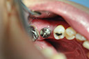 %_tempFileNameImplant%20104b8%
