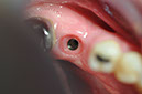%_tempFileNameImplant%20104c1%