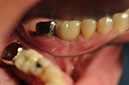 %_tempFileNameImplant%20104c3%
