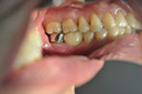%_tempFileNameImplant%20104c4%
