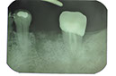 %_tempFileNameImplant%20104d2%
