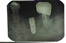 %_tempFileNameImplant%20104d4%