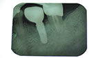 %_tempFileNameImplant%20104d5%