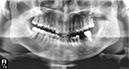 %_tempFileNameImplant%20104d6%