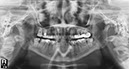 %_tempFileNameImplant%20105a2%