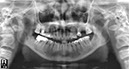 %_tempFileNameImplant%20105b1%