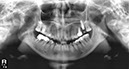 %_tempFileNameImplant%20105d1%