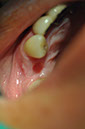 %_tempFileNameImplant%20107a3%
