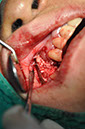 %_tempFileNameImplant%20107b1%