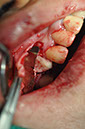 %_tempFileNameImplant%20107b2%