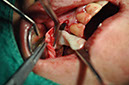 %_tempFileNameImplant%20107b3%