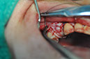 %_tempFileNameImplant%20107b5%