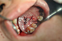 %_tempFileNameImplant%20107b6%