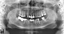 %_tempFileNameImplant%20107b7%