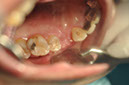%_tempFileNameImplant%20107b8%