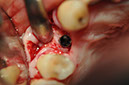 %_tempFileNameImplant%20107c2%