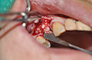 %_tempFileNameImplant%20107c5%