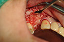 %_tempFileNameImplant%20107c6%