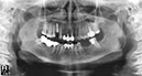 %_tempFileNameImplant%20107c8%