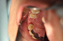 %_tempFileNameImplant%20107d1%