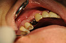 %_tempFileNameImplant%20107d2%