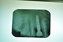 %_tempFileNameImplant%20107d3%