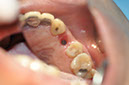 %_tempFileNameImplant%20107d4%