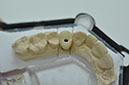 %_tempFileNameImplant%20107d5%