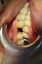 %_tempFileNameImplant%20107d6%