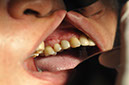 %_tempFileNameImplant%20107d7%