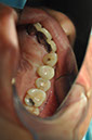 %_tempFileNameImplant%20107d9%