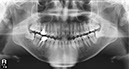 %_tempFileNameImplant%20108a2%