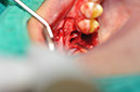 %_tempFileNameImplant%20108a3%
