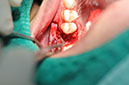 %_tempFileNameImplant%20108b1%