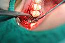 %_tempFileNameImplant%20108b2%