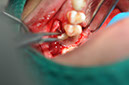 %_tempFileNameImplant%20108b3%