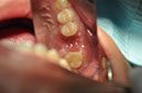 %_tempFileNameImplant%20108b4%