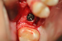 %_tempFileNameImplant%20108b6%